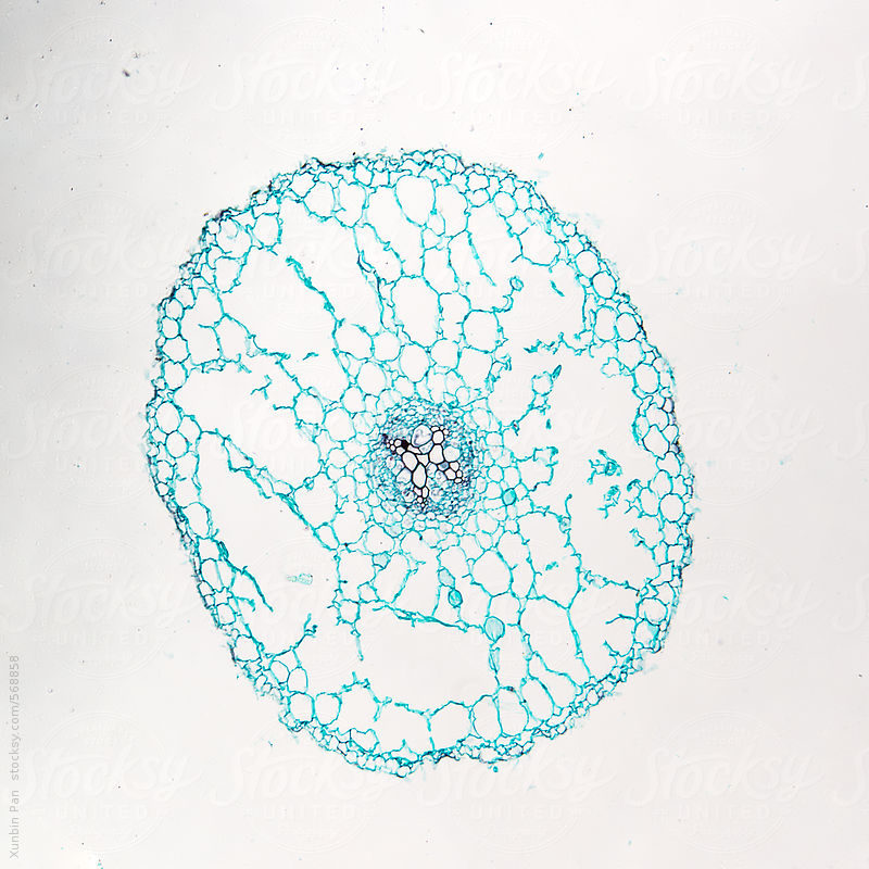 buttercup ranunculus root c.s. micrograph. by xunbin pan